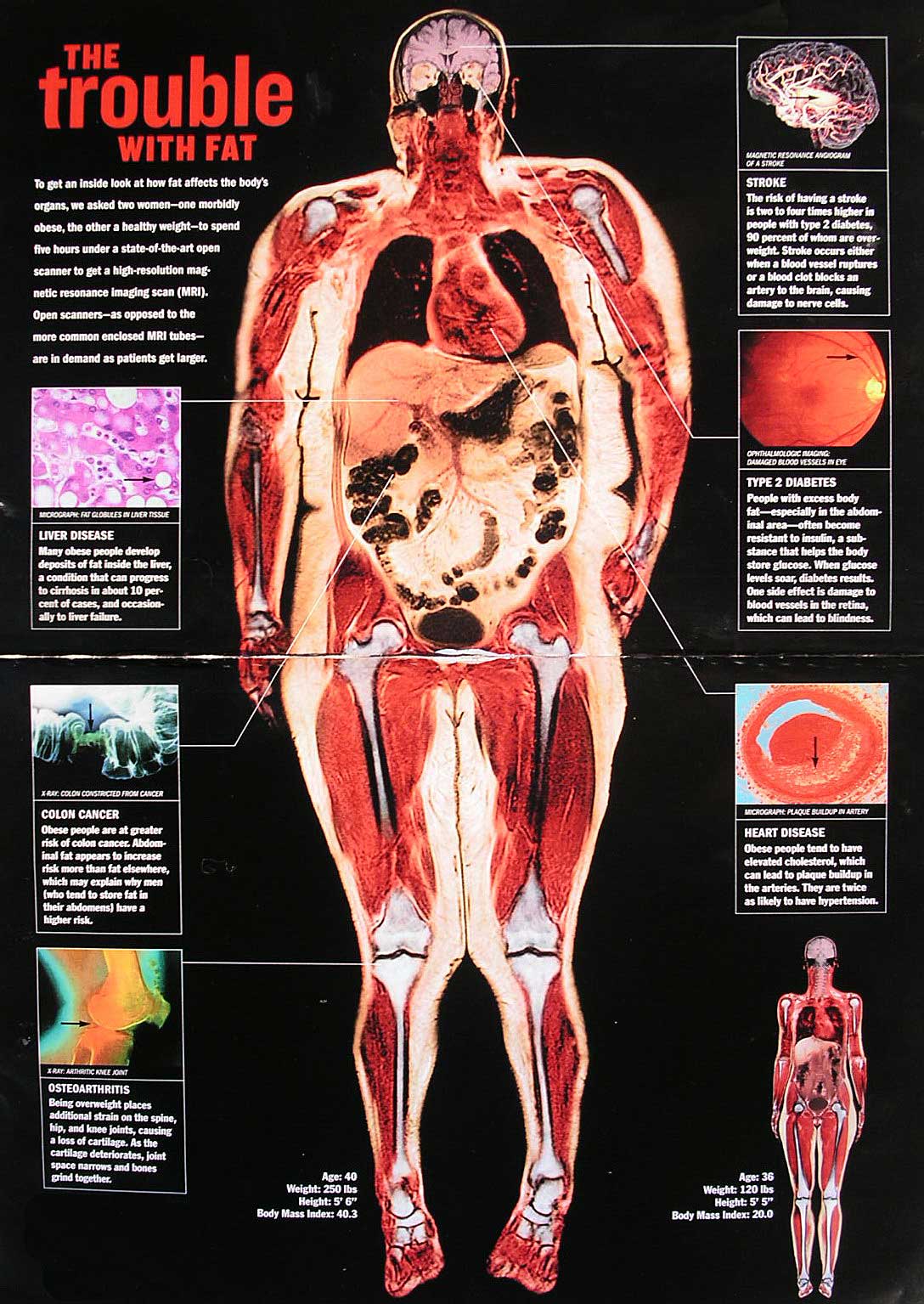 Understanding Your InBody Results and How Nutrition Impacts Your