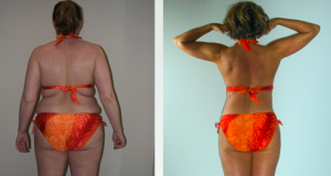 cynthia-before-after-back