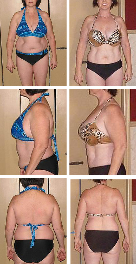 woman weight loss transformation before after